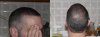 front back 4th month.jpg