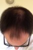 hair before.JPG