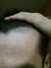hairline 2 right.jpg hairline 2 right.jpg