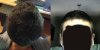 pelo.jpg