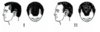 malestages_pic1a.jpg