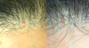 Hair-1.png