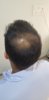unshaven before 3.jpeg