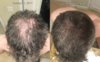 gourmetstylewellness.com--Dermarol-Nizoral.jpg