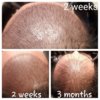 3 months shedding.jpg