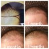 3 months temple.jpg