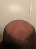 bald5.jpg