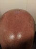 bald6.jpg
