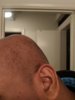 bald3.jpg