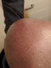 bald.jpg