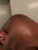 bald2.jpg