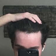 thebaldingteen