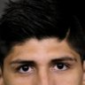 LowHairLine