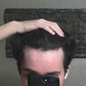 thebaldingteen