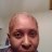 Alopecia to Afro