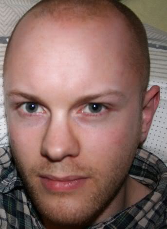 bald-1.jpg