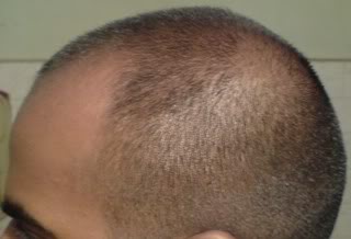 Sep2009left.jpg