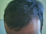 Before.jpg