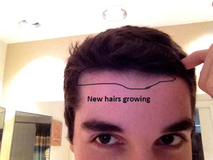 2uol65g.png