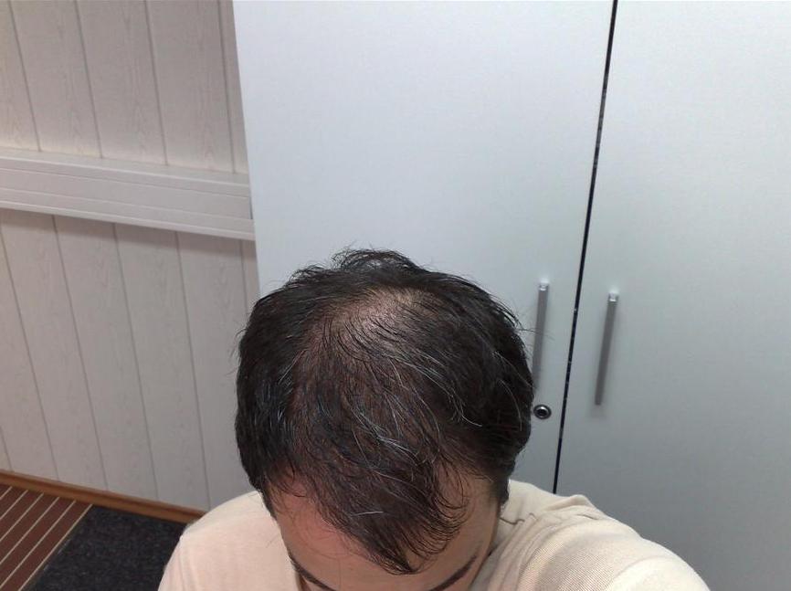 before.jpg