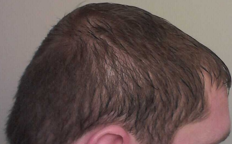 right_wet.jpg