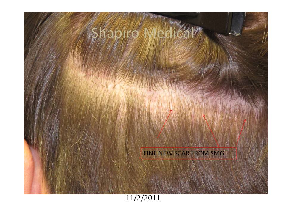 Slide9-2.jpg