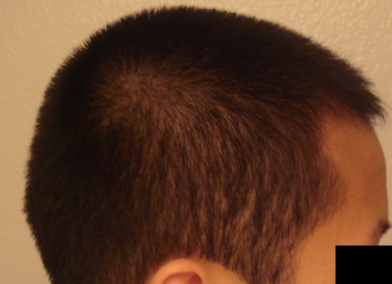 rightside_dry.jpg