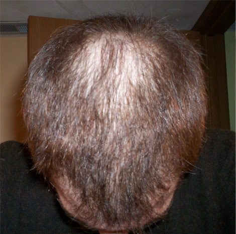 TopFront1.jpg