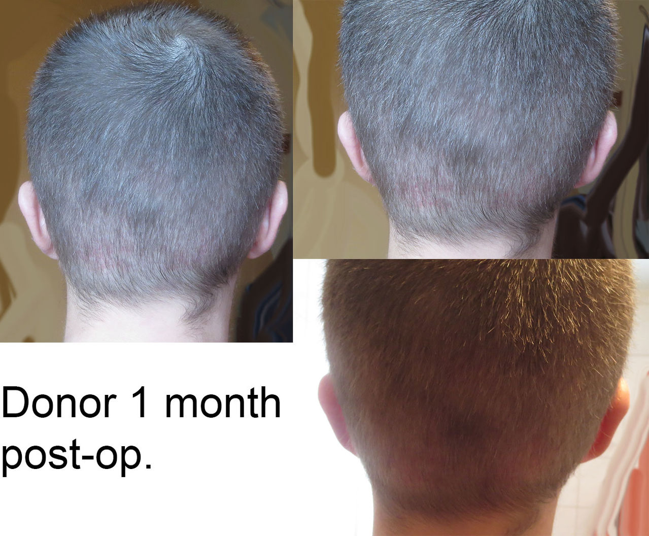 Donor1month.jpg