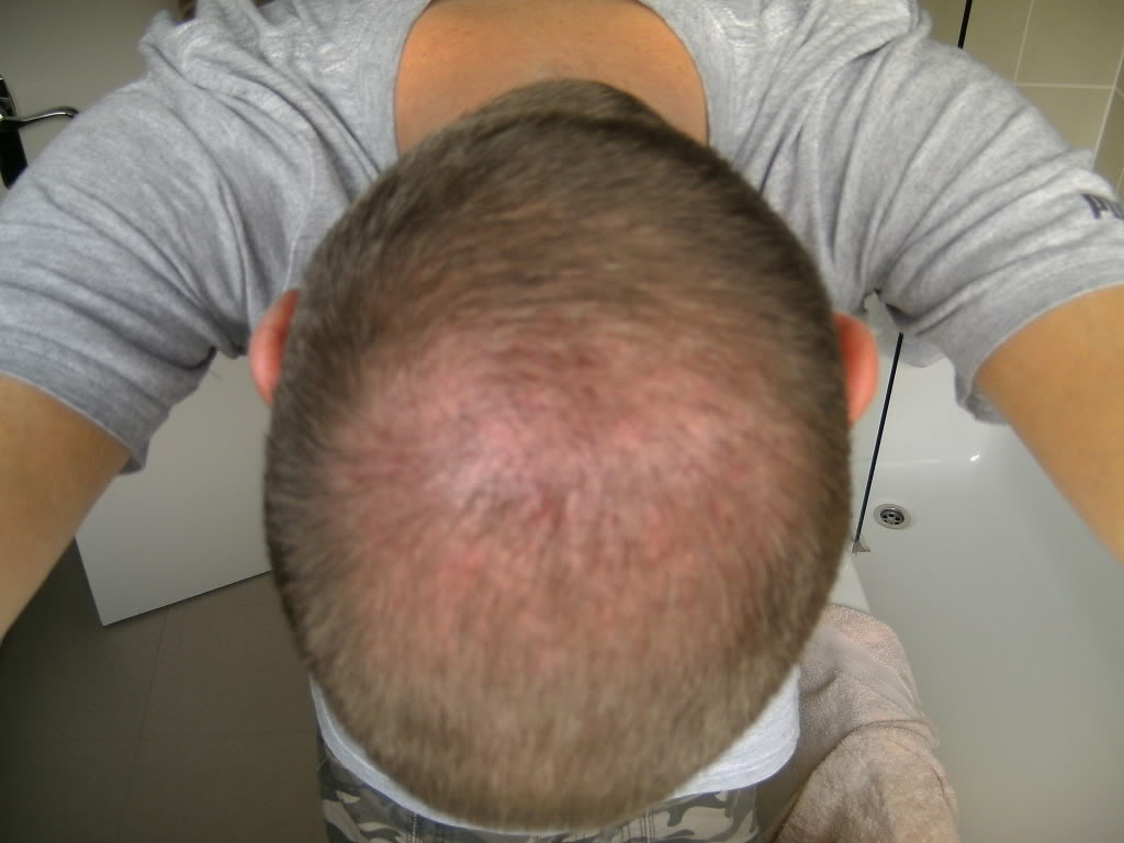 8weekspostop001.jpg
