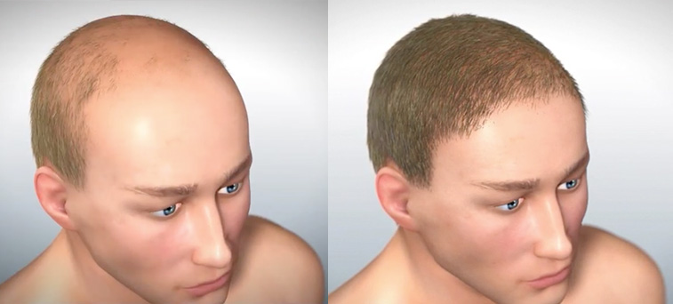 Replicel.jpg