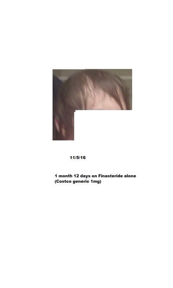 iAr3dMy.jpg