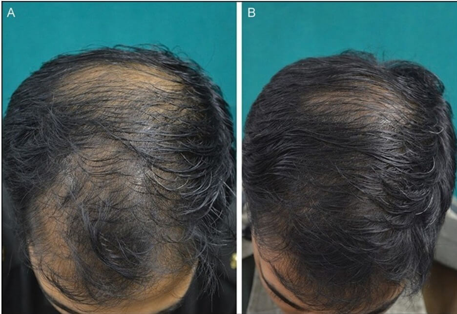 www.hairguard.com