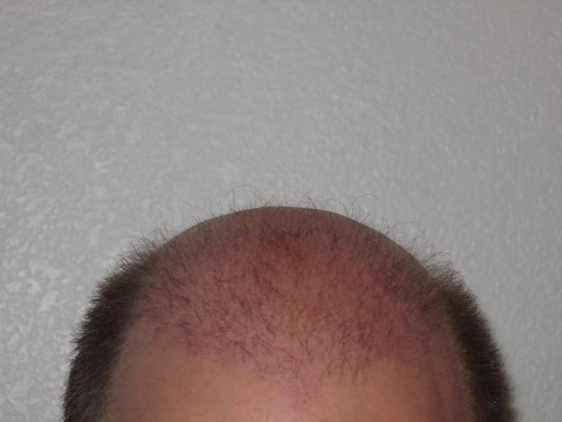 head1-2weeks800.jpg
