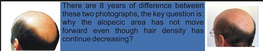Not_more_progresion_of_bald_ares.jpg