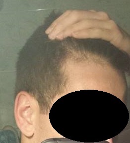 6zAzz0o.jpg