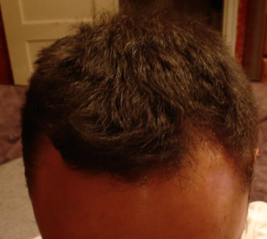 DermAfter1.jpg