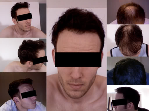 hair.jpg