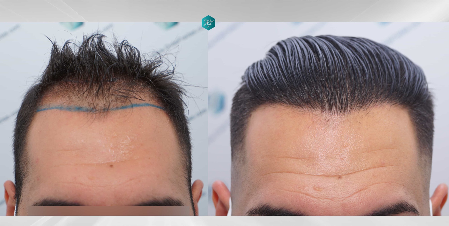folliclethought.com
