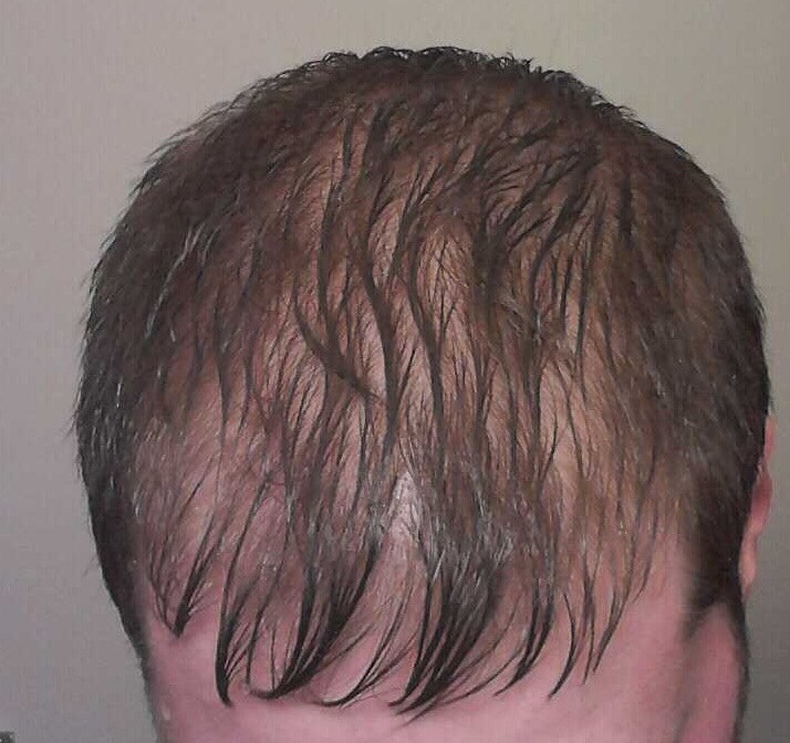 top_wet.jpg