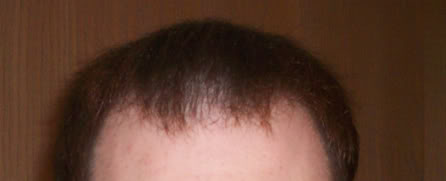 Front2.jpg
