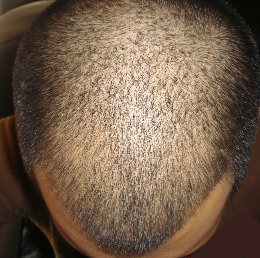 ng2fx0.jpg