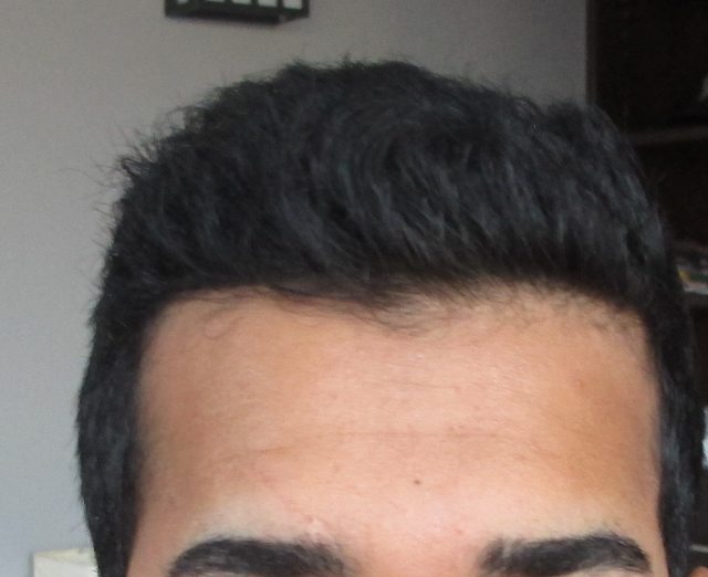 XlQq5CCl.jpg