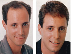 before_men.jpg