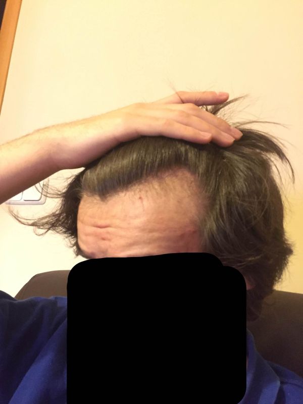 0GgANo.jpg
