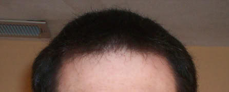 Front3.jpg