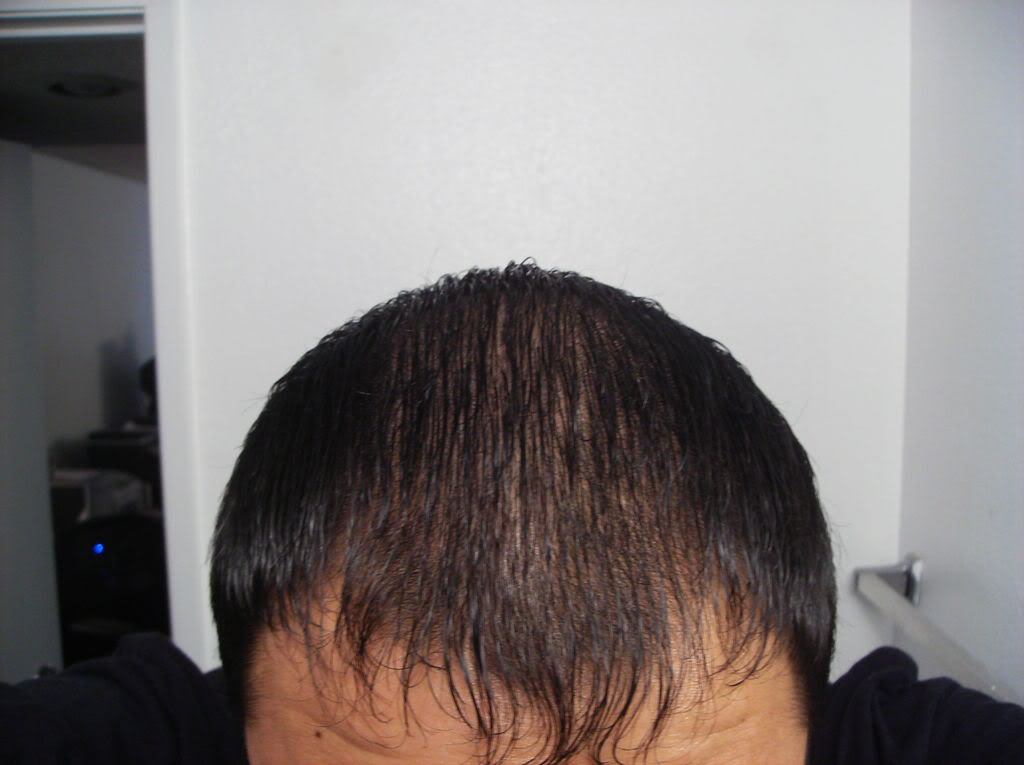 hair5.jpg