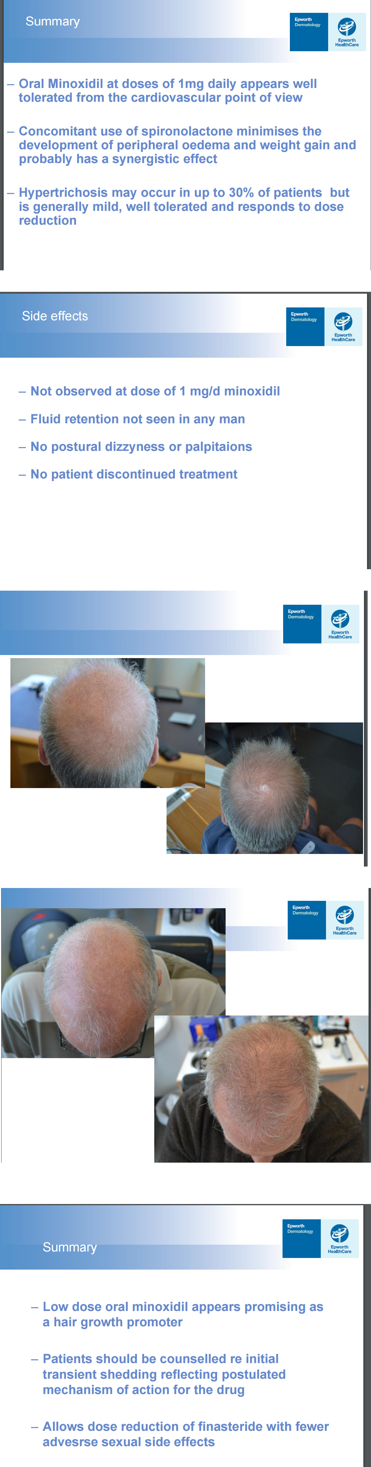 oralminoxidil2.jpg