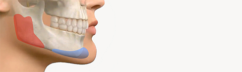 Mandibular-Implants_03.jpg