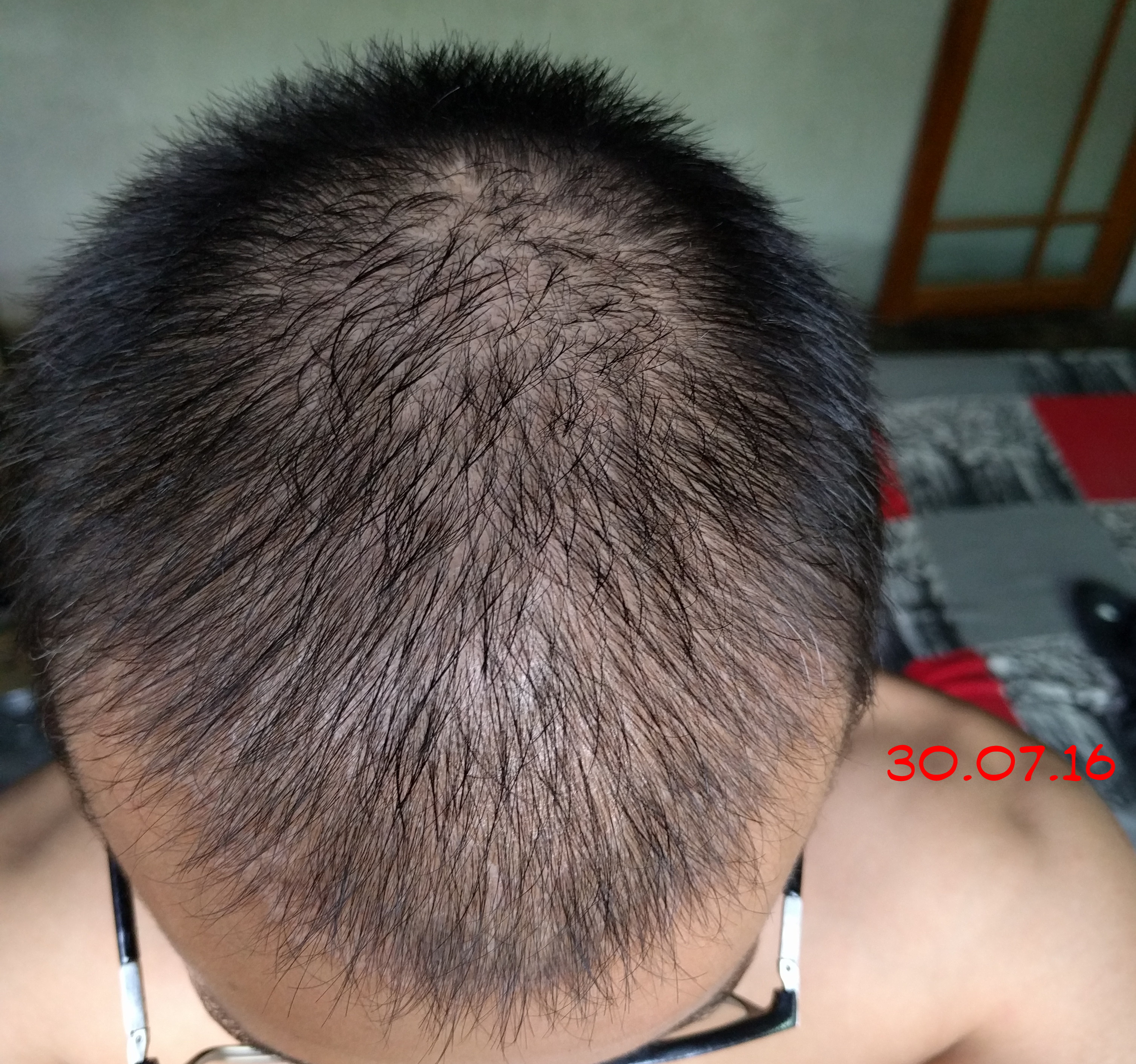 sNCuE3G.jpg